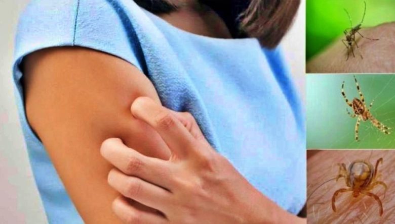 نصائح طبية لعلاج لدغات الحشرات