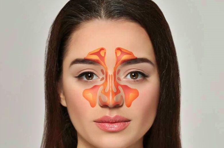 السلائل الأنفية