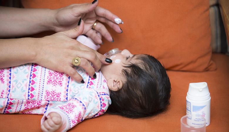 المضاعفات الجلدية للرضع وطرق علاجها المضاعفات الجلدية للرضع وطرق علاجها