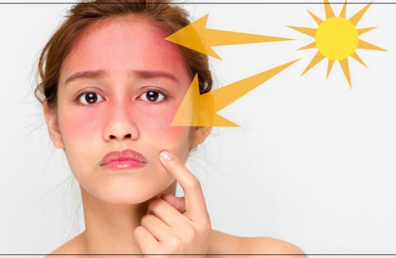 أشعة الشمس وتسريع ظهور علامات الشيخوخة