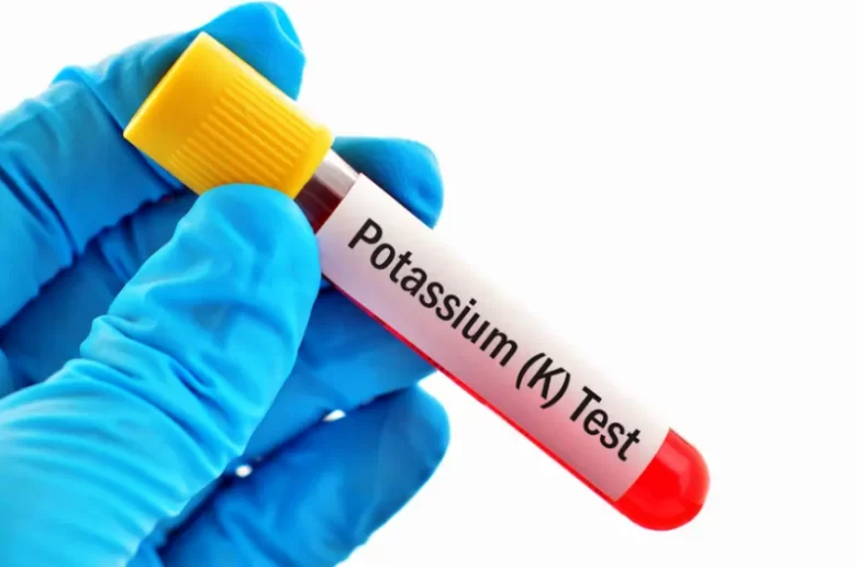 5 أعراض تدل على انخفاض البوتاسيوم بالجسم 5 أعراض تدل على انخفاض البوتاسيوم بالجسم
