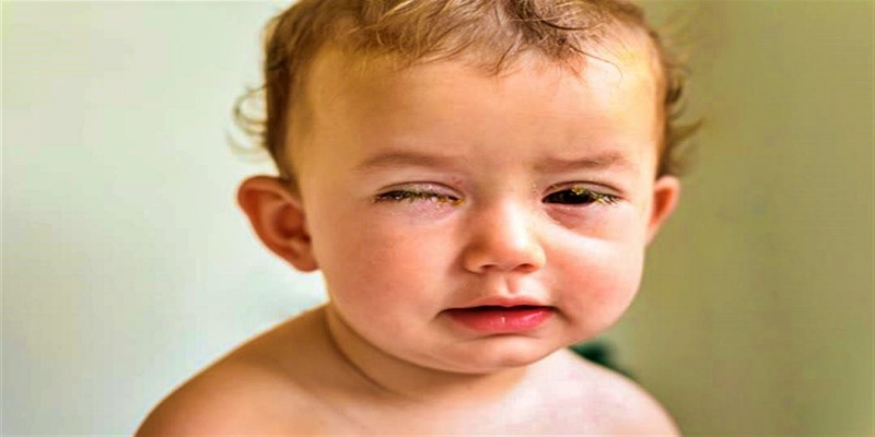 ما هي أهم الأعراض التي تظهر على الطفل في حالة إصابته بالعين الوردية؟