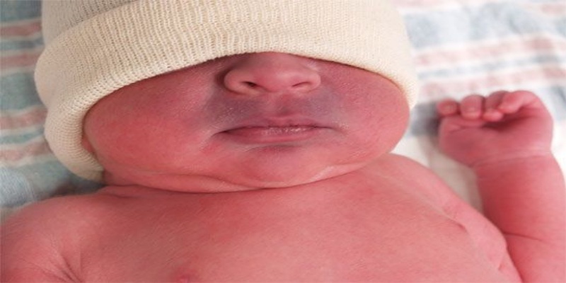 لماذا يعاني الأطفال حديثي الولادة من زرقة محيطية؟