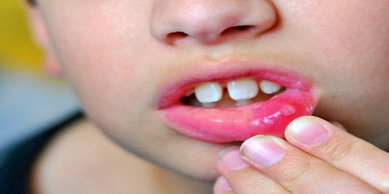 كيف يمكن التعرف على حرارة الفم داخل فم الطفل؟
