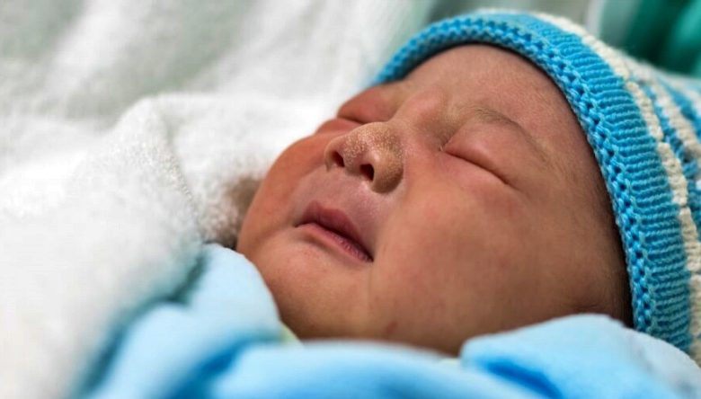 الشفاه الداكنة عند الأطفال حديثي الولادة