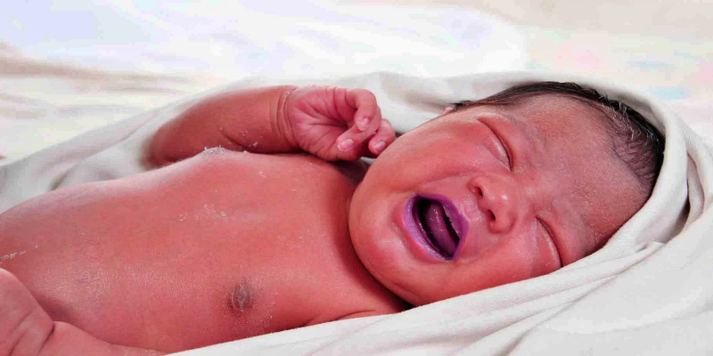 ما هي حالة الرضيع ذو الشفاه الداكنة؟