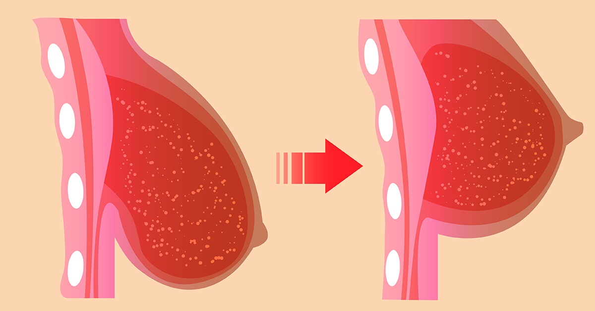  أسباب ترهل الثدي بعد إيقاف الرضاعة الطبيعية