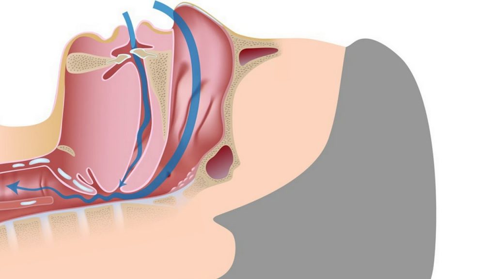 أسباب توقف التنفس أثناء النوم عند الأطفال