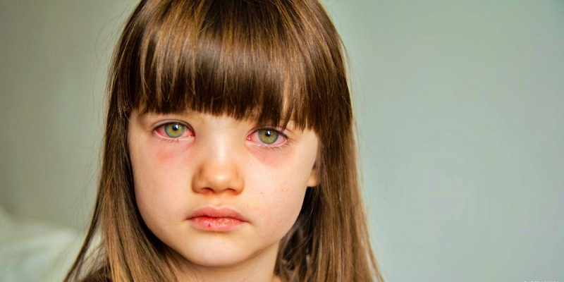 ما هي أهم أسباب إصابة الطفل بالعين الوردية؟
