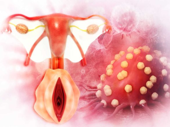 الدمامل المهبلية