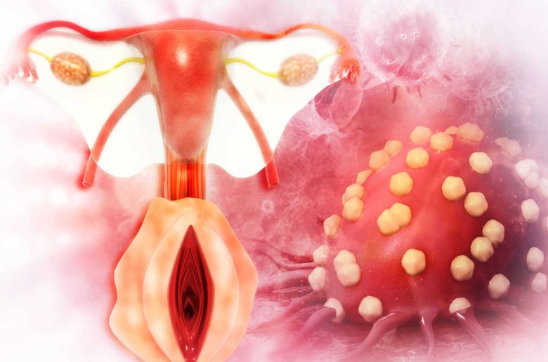 الدمامل المهبلية