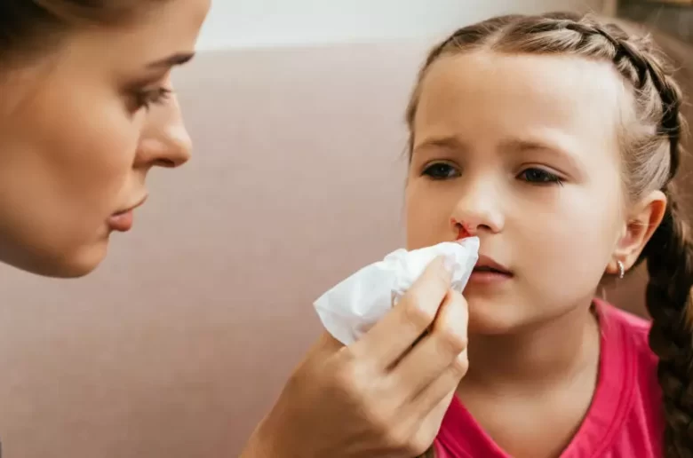 الهيموفيليا عند الأطفال