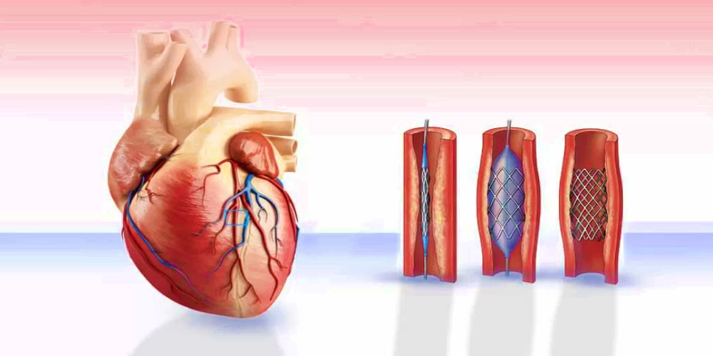 ما هي مضاعفات الإصابة بأمراض القلب الروماتيزمية عند الأطفال؟