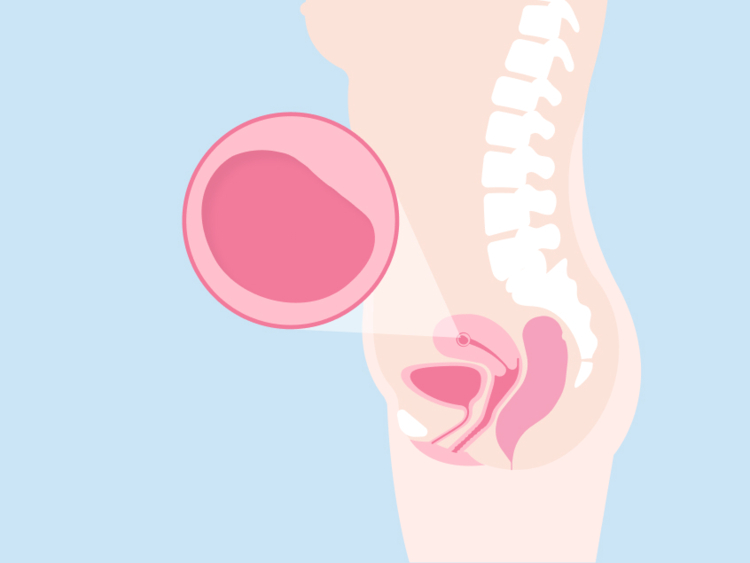 ما المقصود بالبويضة التالفة أو Blighted Ovum؟