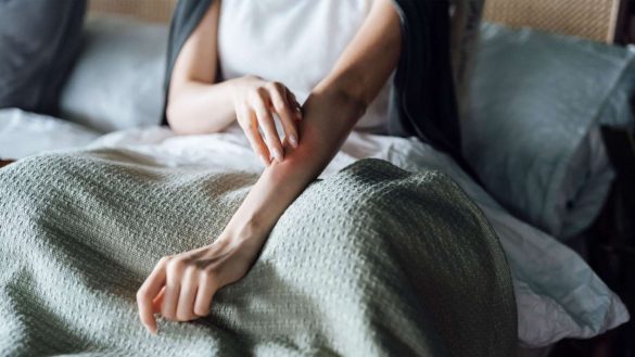 مشكلة الخدوش أثناء النوم