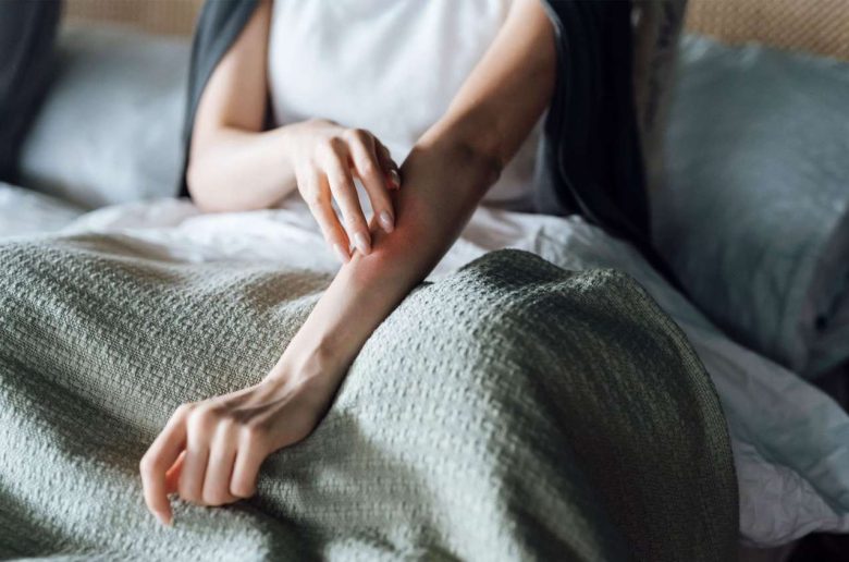 مشكلة الخدوش أثناء النوم