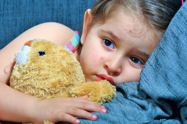 بشرة الطفل وكيف يتم حمايتها من نمو البثور عليها