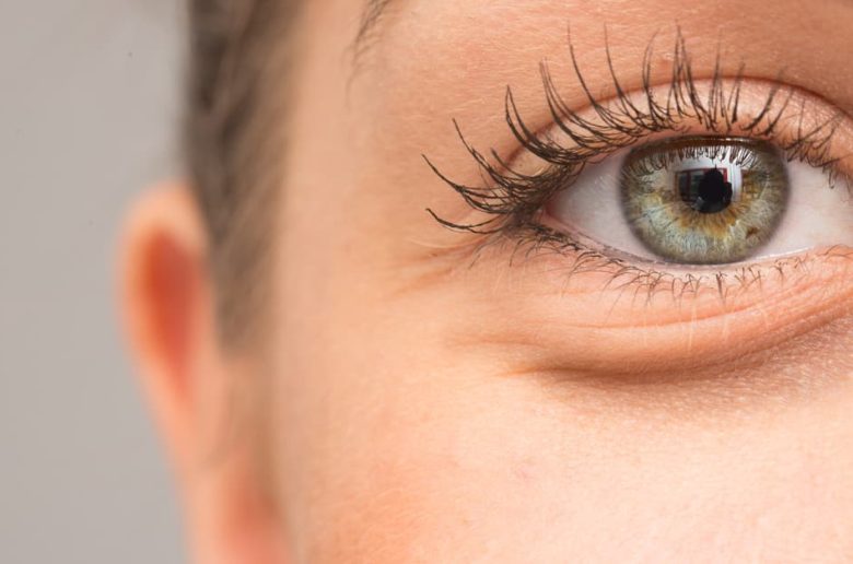 7 طرق للتخلص من أكياس تحت العين 7 طرق للتخلص من أكياس تحت العين