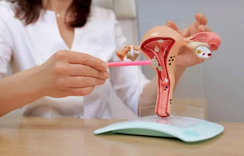 إستئصال الرحم الجزئي إستئصال الرحم الجزئي