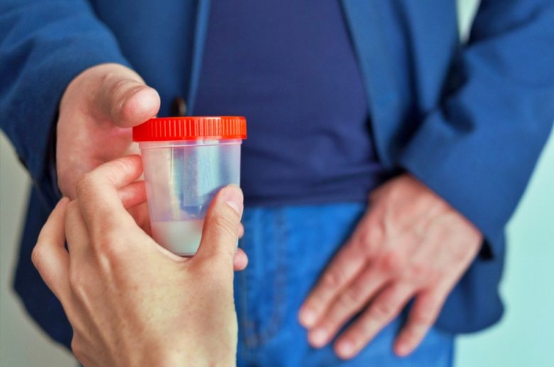 تحليل السائل المنوي