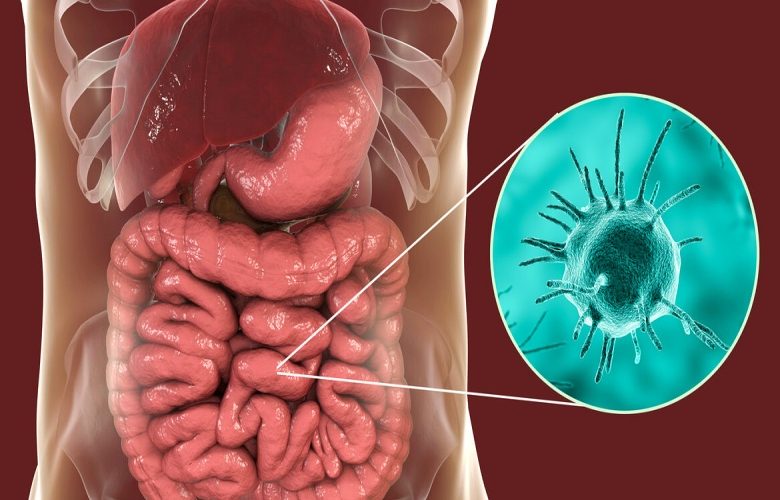 5 أعشاب طبيعية لعلاج الإلتهابات الطفيلية المعوية