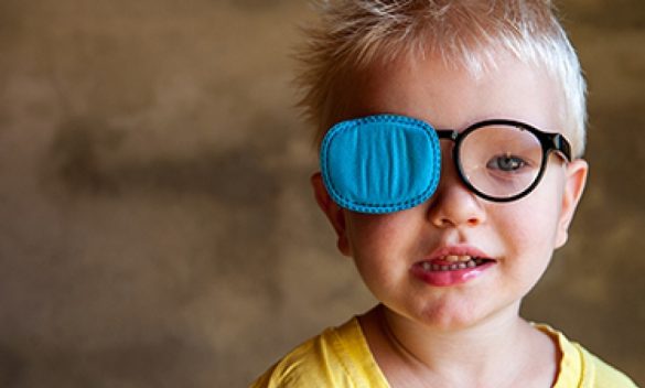 العين الكسولة لدى الأطفال