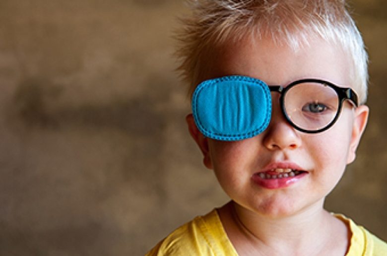 العين الكسولة لدى الأطفال