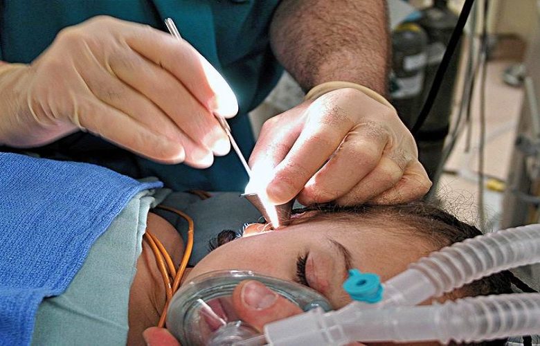 قسطرة طبلة الأذن وكل ما يتعلق بها من معلومات قسطرة طبلة الأذن وكل ما يتعلق بها من معلومات