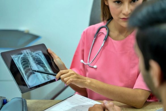 مرض السل الرئوي وأهم مراحل الإصابه به