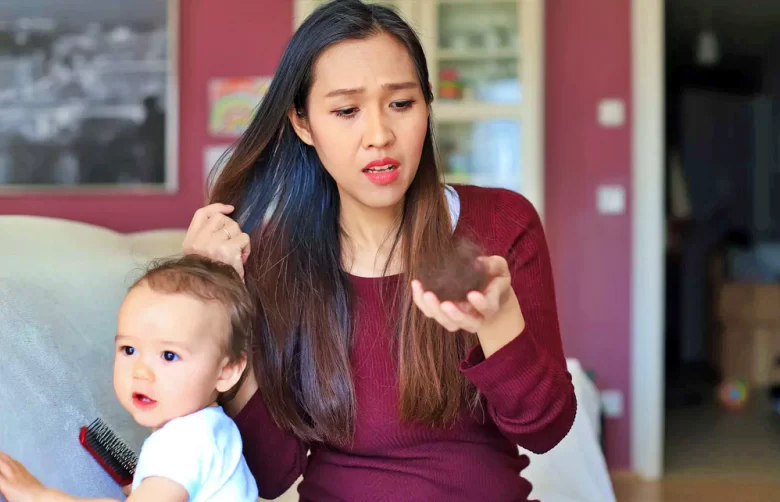 تساقط الشعر بعد الولادة وكيف يتم علاجه؟