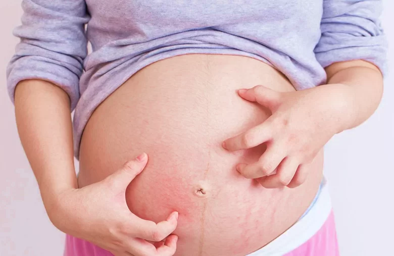 آلام منطقة السرة خلال فترة الحمل وأسباب حدوث الإصابة بها آلام منطقة السرة خلال فترة الحمل وأسباب حدوث الإصابة بها