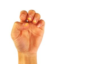 أظافر صفراء