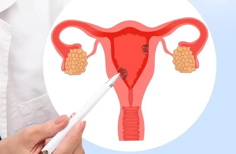 ممارسة العلاقة الجنسية مع السلائل الرحمية