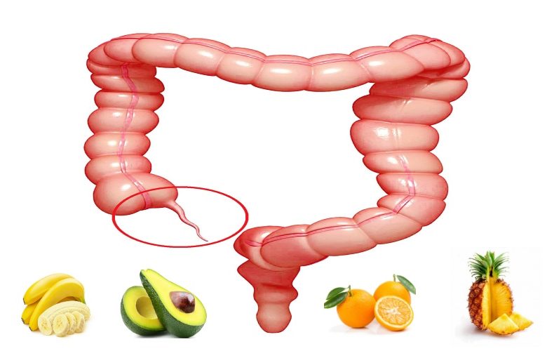 أهم الفواكه التي يجب تناولها بعد إستئصال الزائدة الدودية