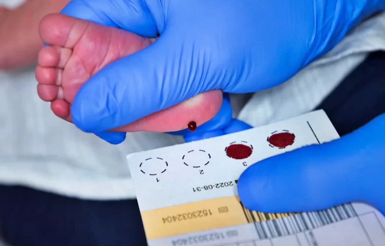 فحص الكعب لحديثي الولادة وأهم الأمراض التي يتم إكتشافها من خلاله