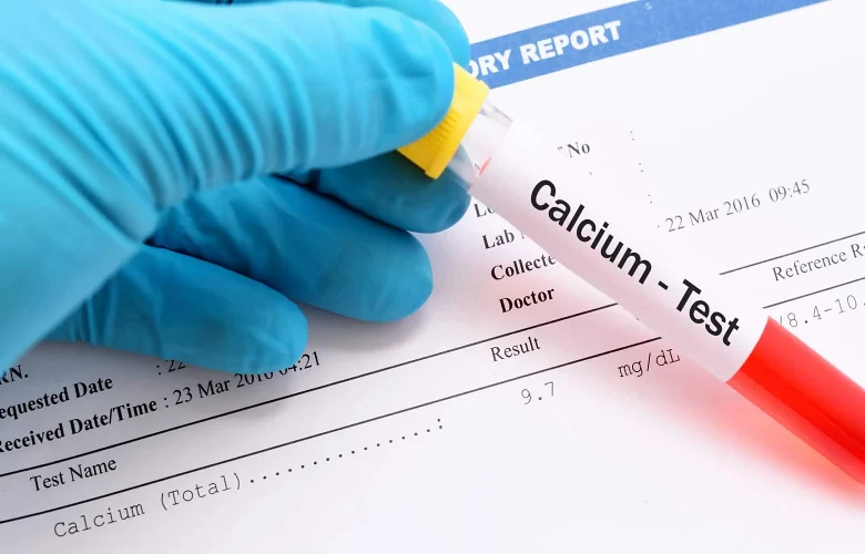 إختبار مستوى الكالسيوم في الدم ومتى يتم اللجوء إليه؟