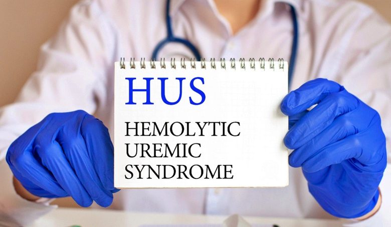 متلازمة إنحلال الدم اليوريمية (HUS) متلازمة إنحلال الدم اليوريمية (HUS)