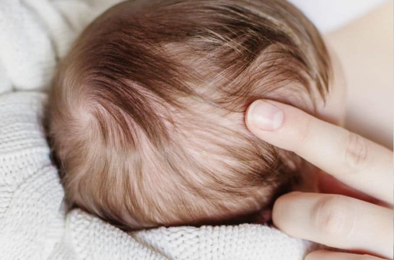 شكل اليافوخ عند حديثي الولادة