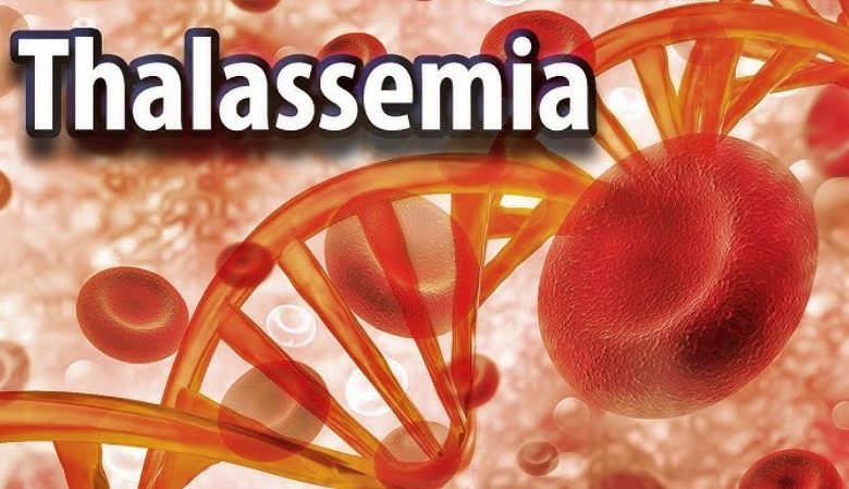 مرض الثلاسيميا وأهم طرق علاجه بشكل طبي سليم