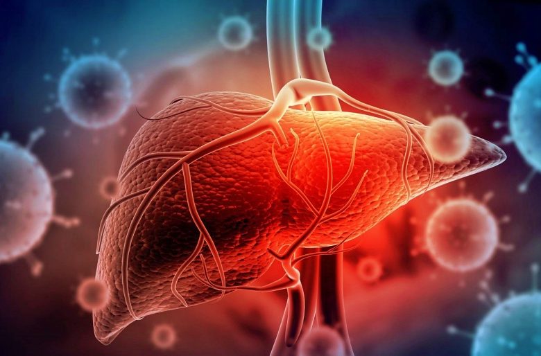 إلتهاب الكبد الحاد.. ما هو؟ وكيفية حدوث الإصابة به؟