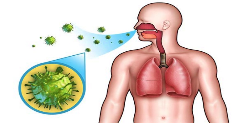 ما هي عدوى الجهاز التنفسي العلوي؟