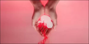 الإجهاض