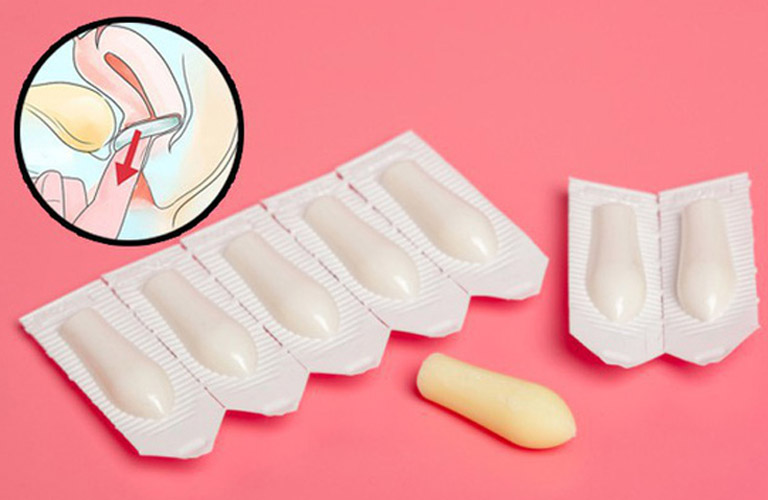 التحاميل المهبلية