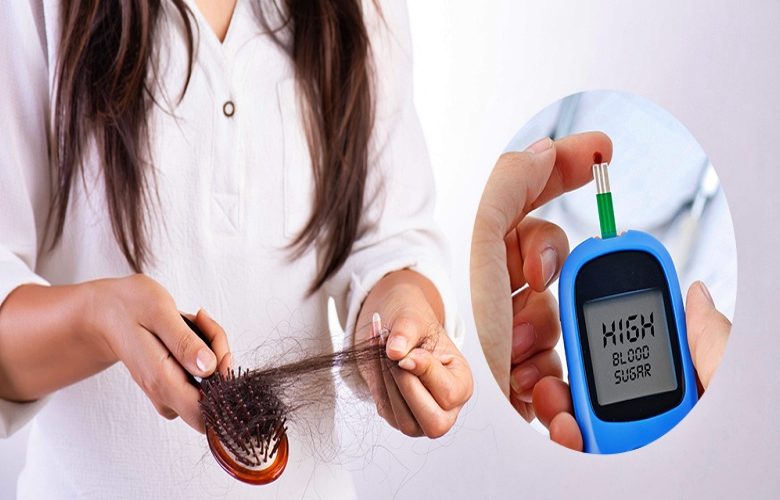 تساقط الشعر ومرض السكري.. ما العلاقة بينهما؟