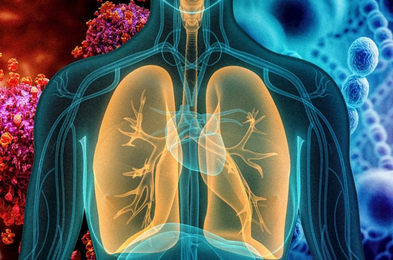 الالتهاب الرئوي الجرثومي.. الأعراض والأسباب وطرق العلاج
