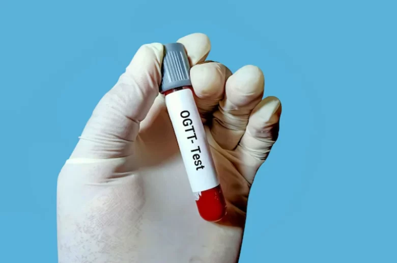 اختبار تحمل الجلوكوز عن طريق الفم (OGTT) لمرضى السكري.. ما هو؟