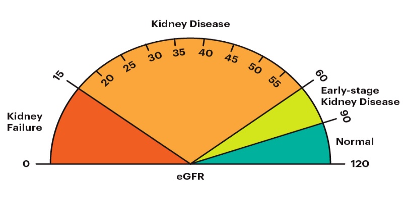 ما تعني نتائج اختبار الـ eGFR؟