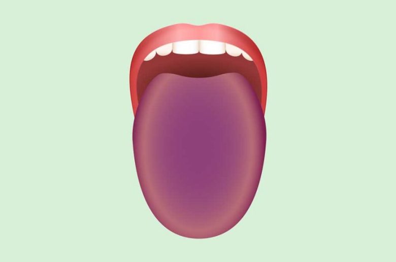 ماذا يقول لون لسانك عن صحتك ؟