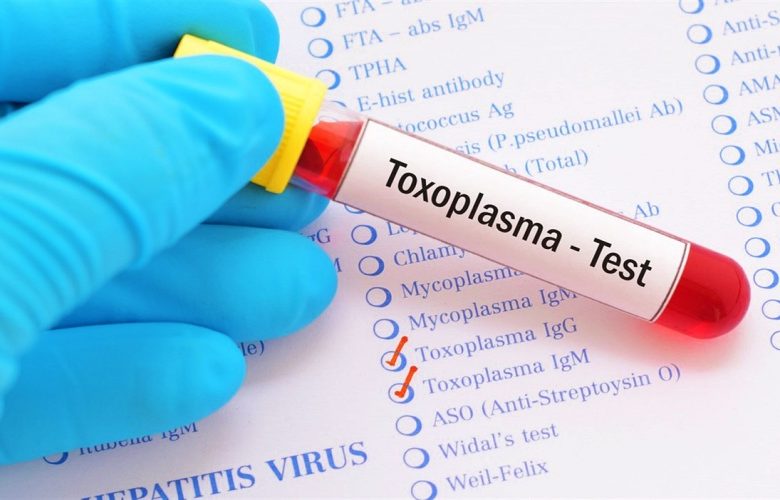 داء المقوسات (عدوى التكسوبلازما) وأهم مسببات الإصابة به