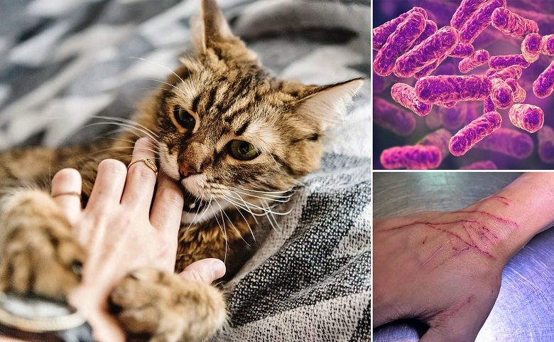 العدوى الناجمة عن خدوش القطط وكيف نتعامل معها؟